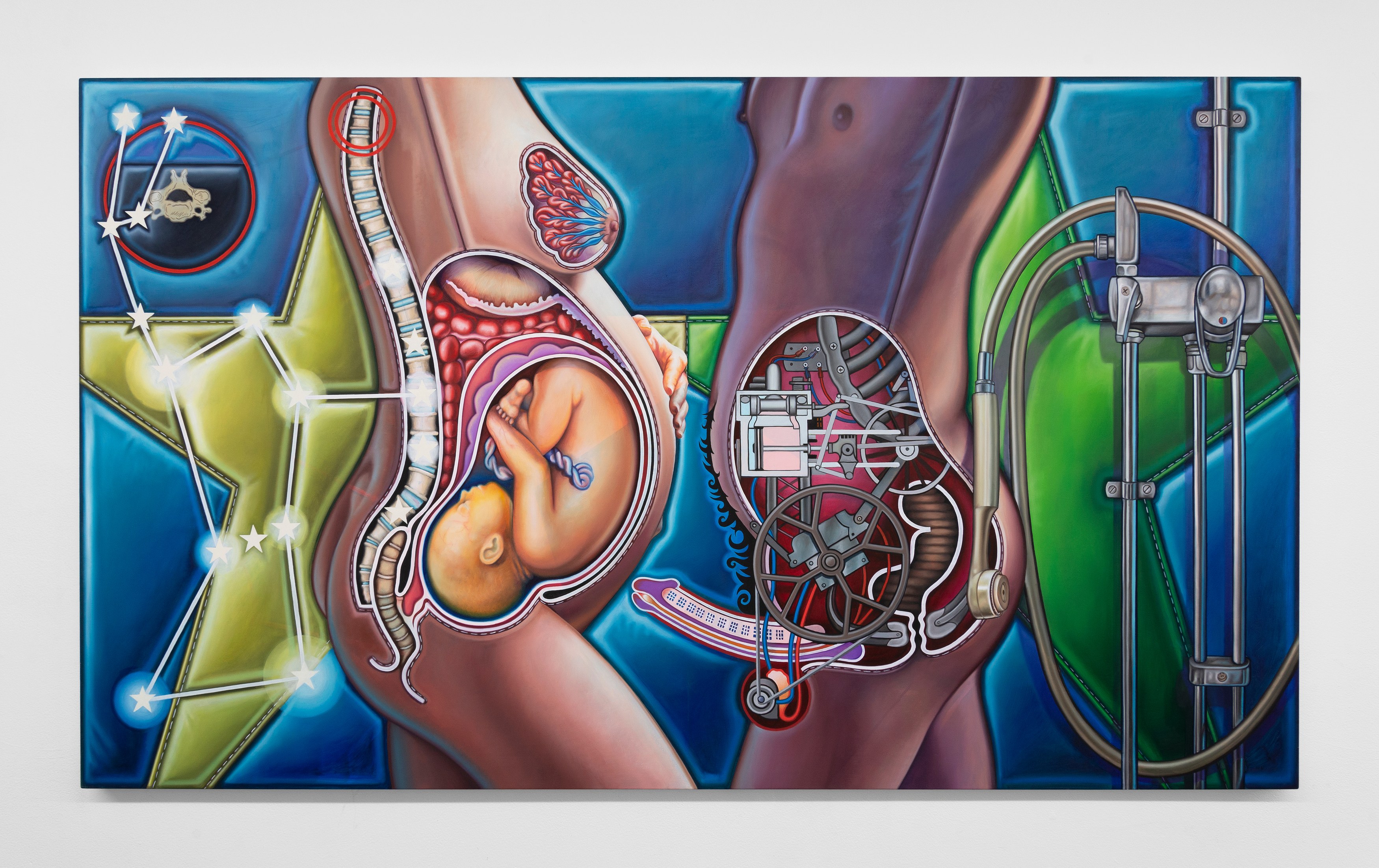 Orion Martin, Pressure Head at Derosia, photo 5