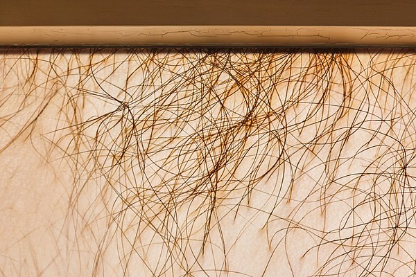 Image 6 of 7