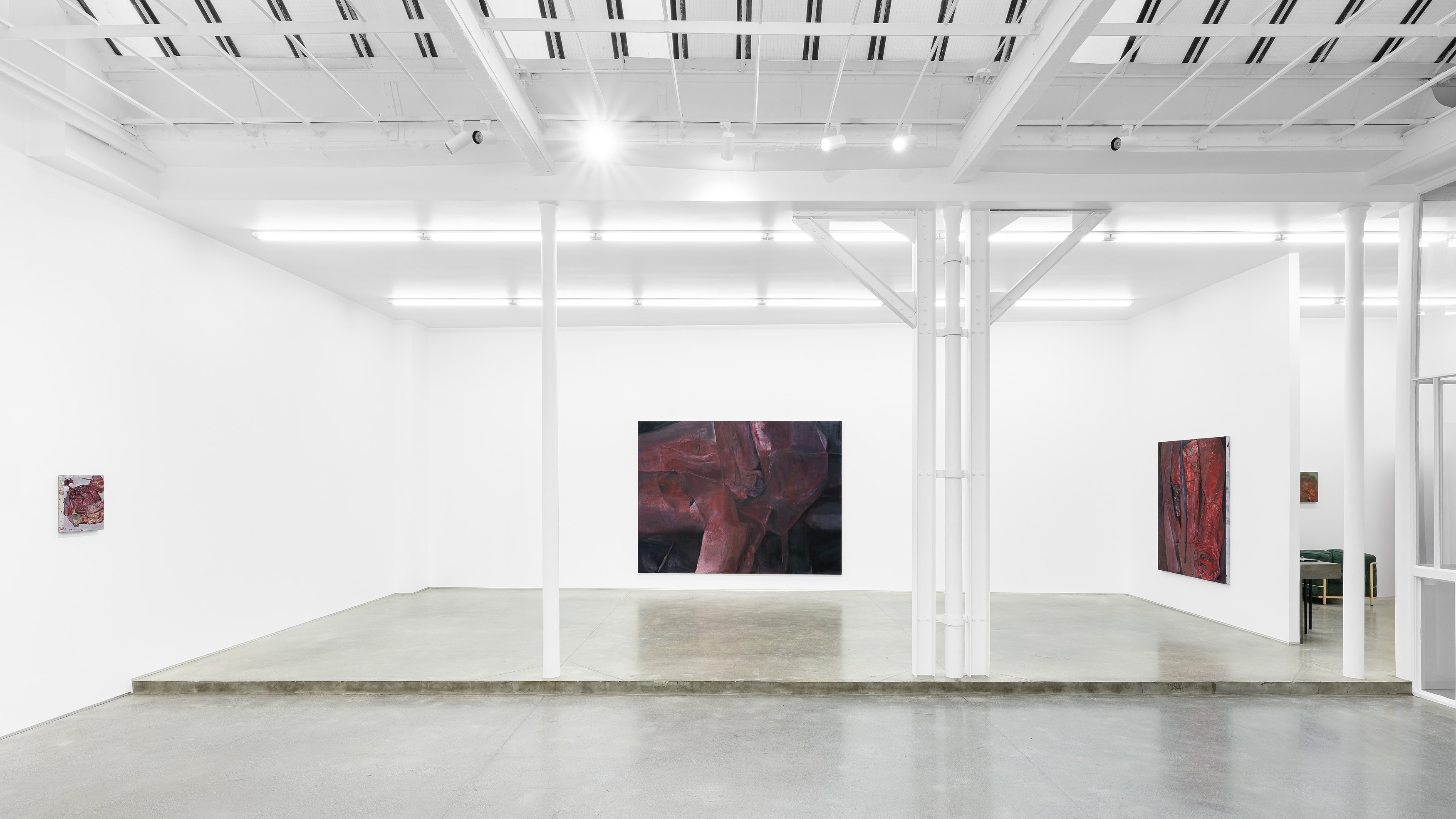 Keunmin Lee, When hallucination is no longer a symptom at Galerie Derouillon, photo 7
