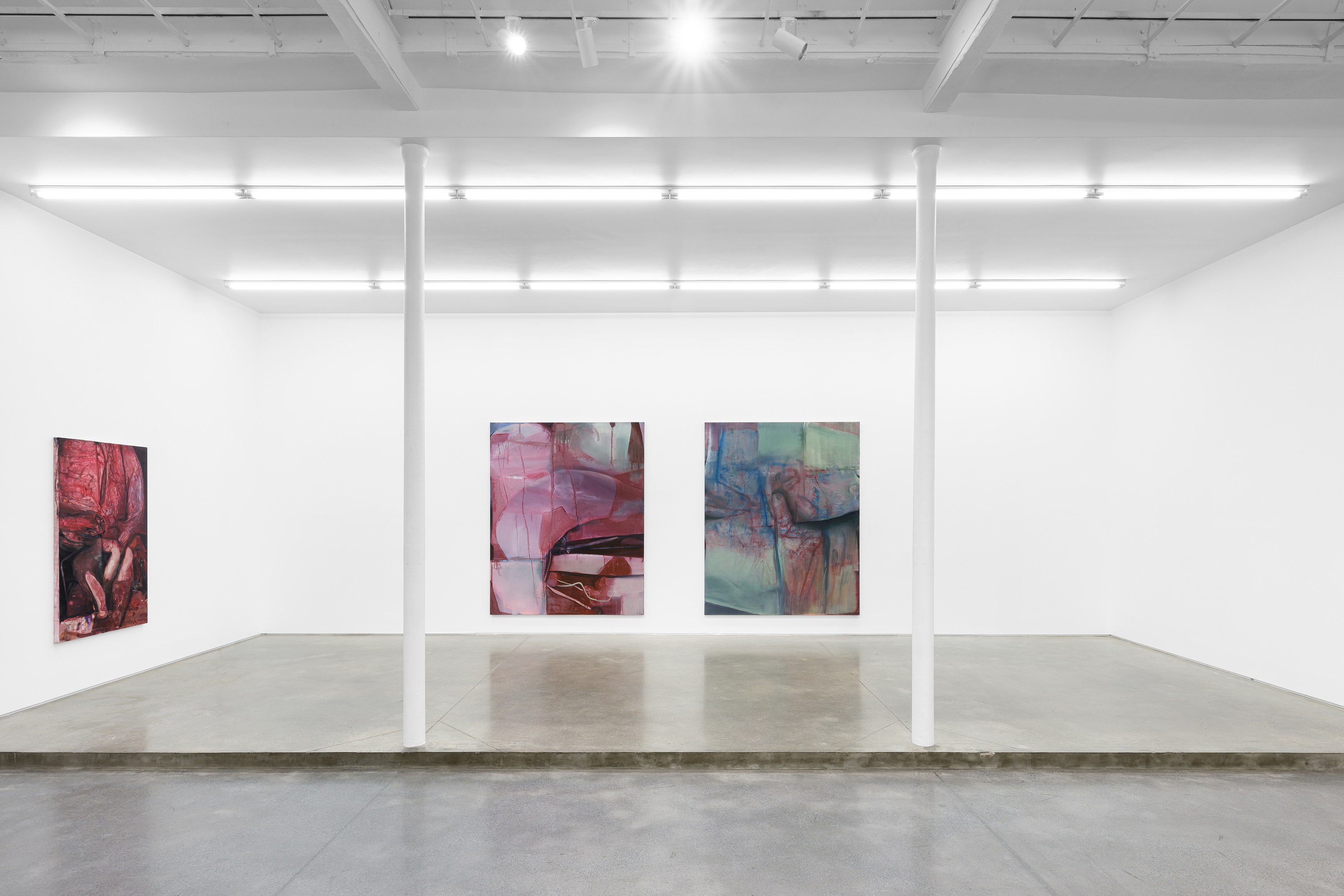 Keunmin Lee, When hallucination is no longer a symptom at Galerie Derouillon, photo 11