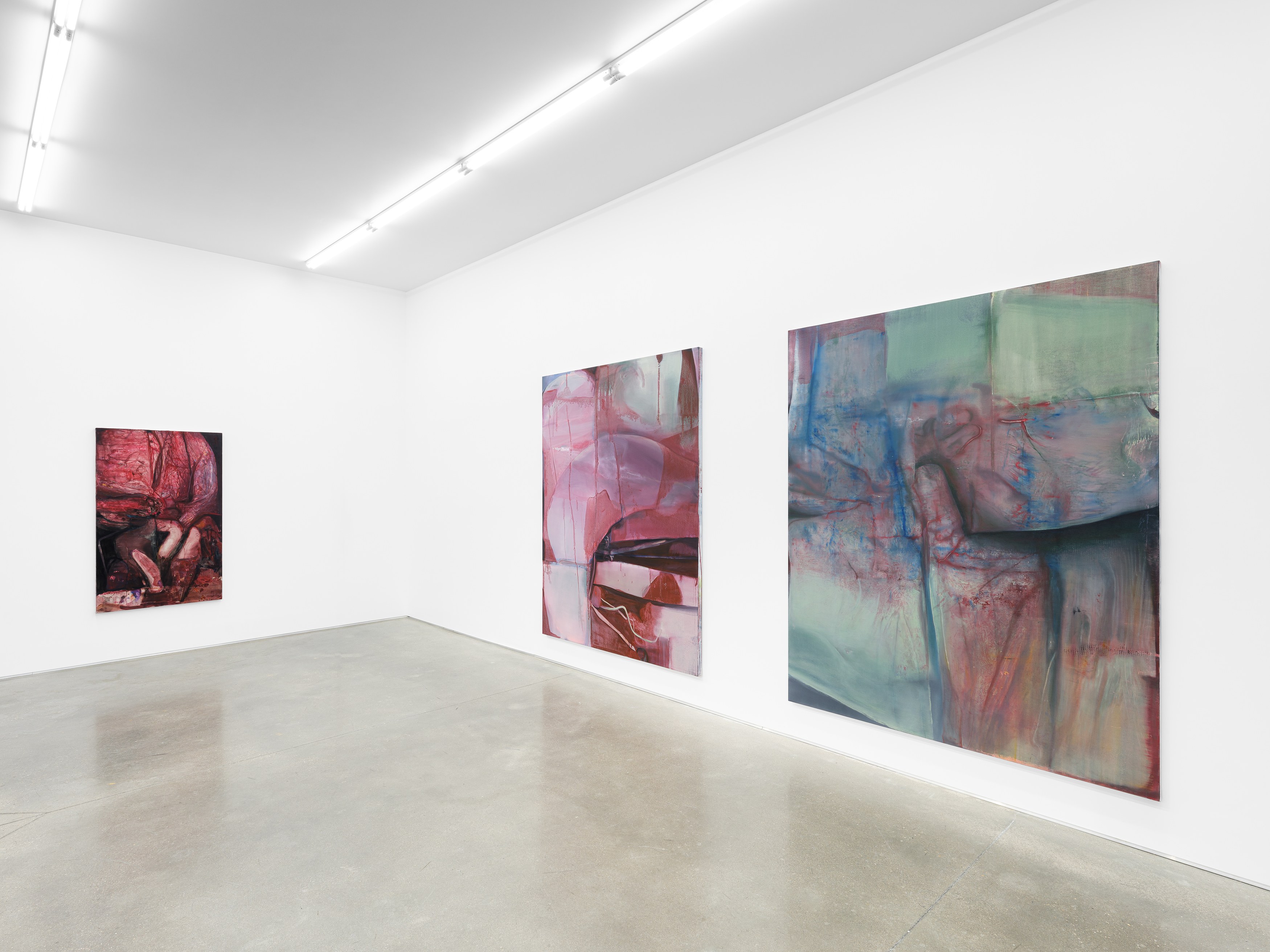 Keunmin Lee, When hallucination is no longer a symptom at Galerie Derouillon, photo 13