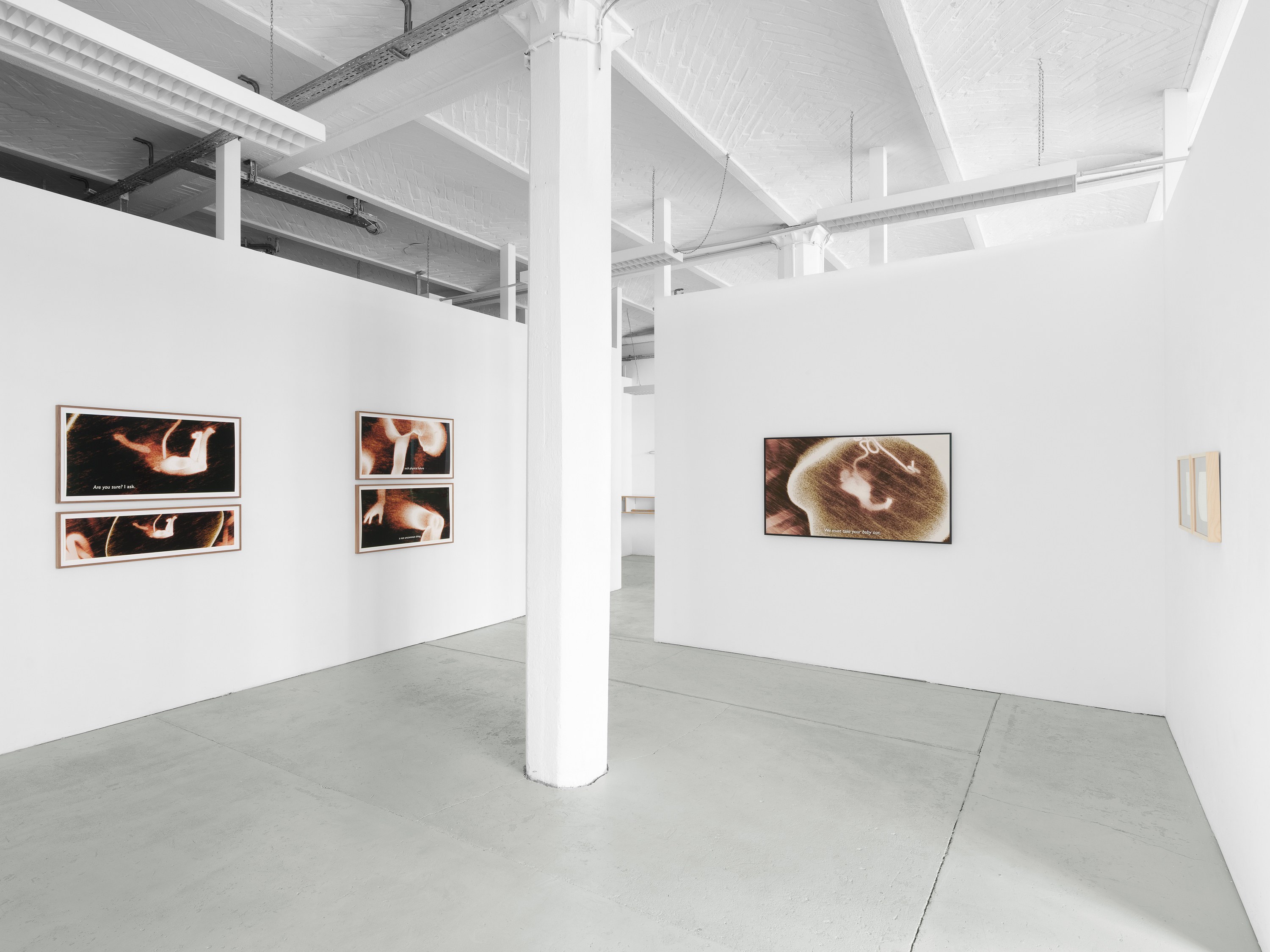 Ana Maria Caballero, Echo Graph at Office Impart, photo 2