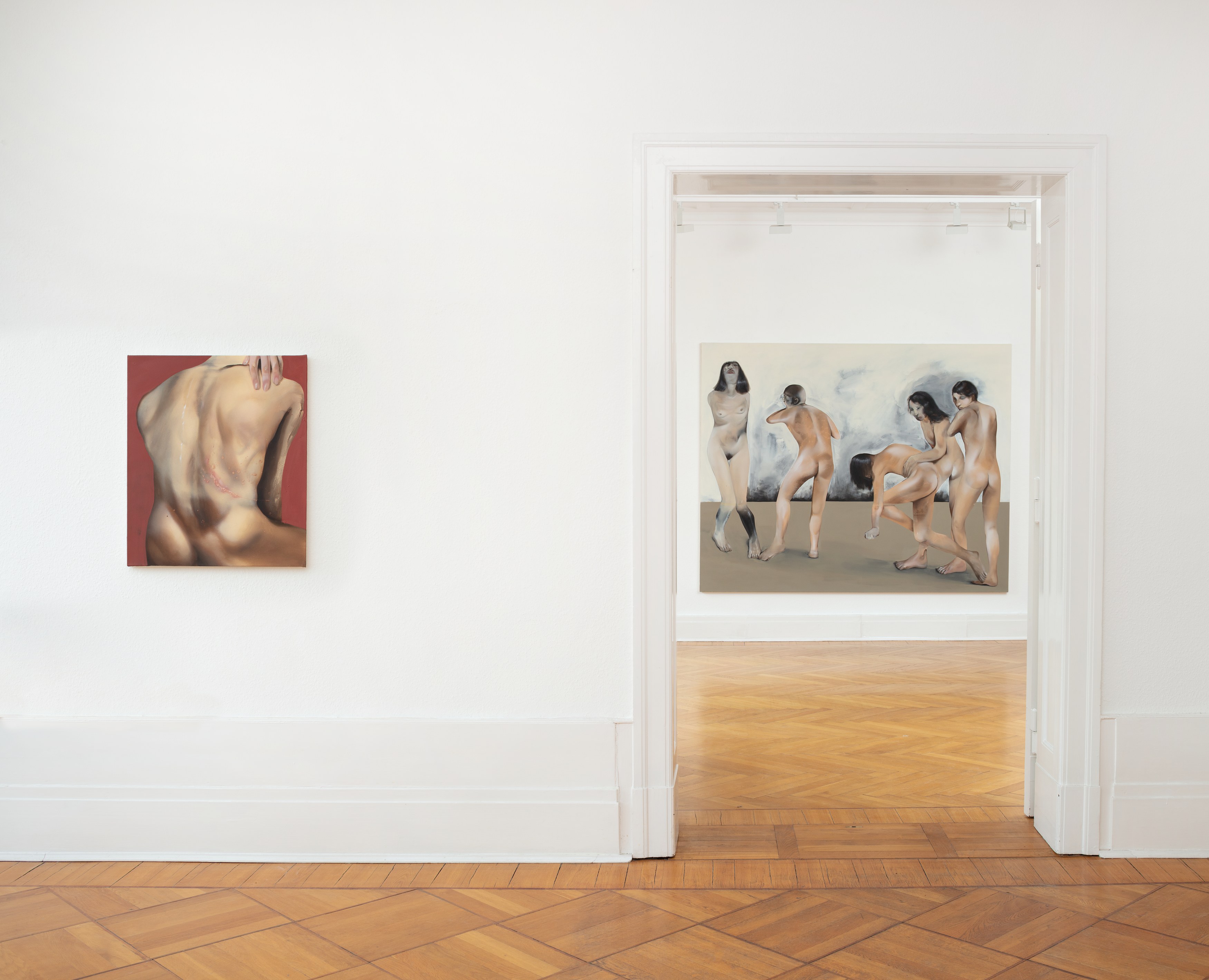 Elsa Rouy, I Pictured Skin at Gnyp Gallery, photo 8
