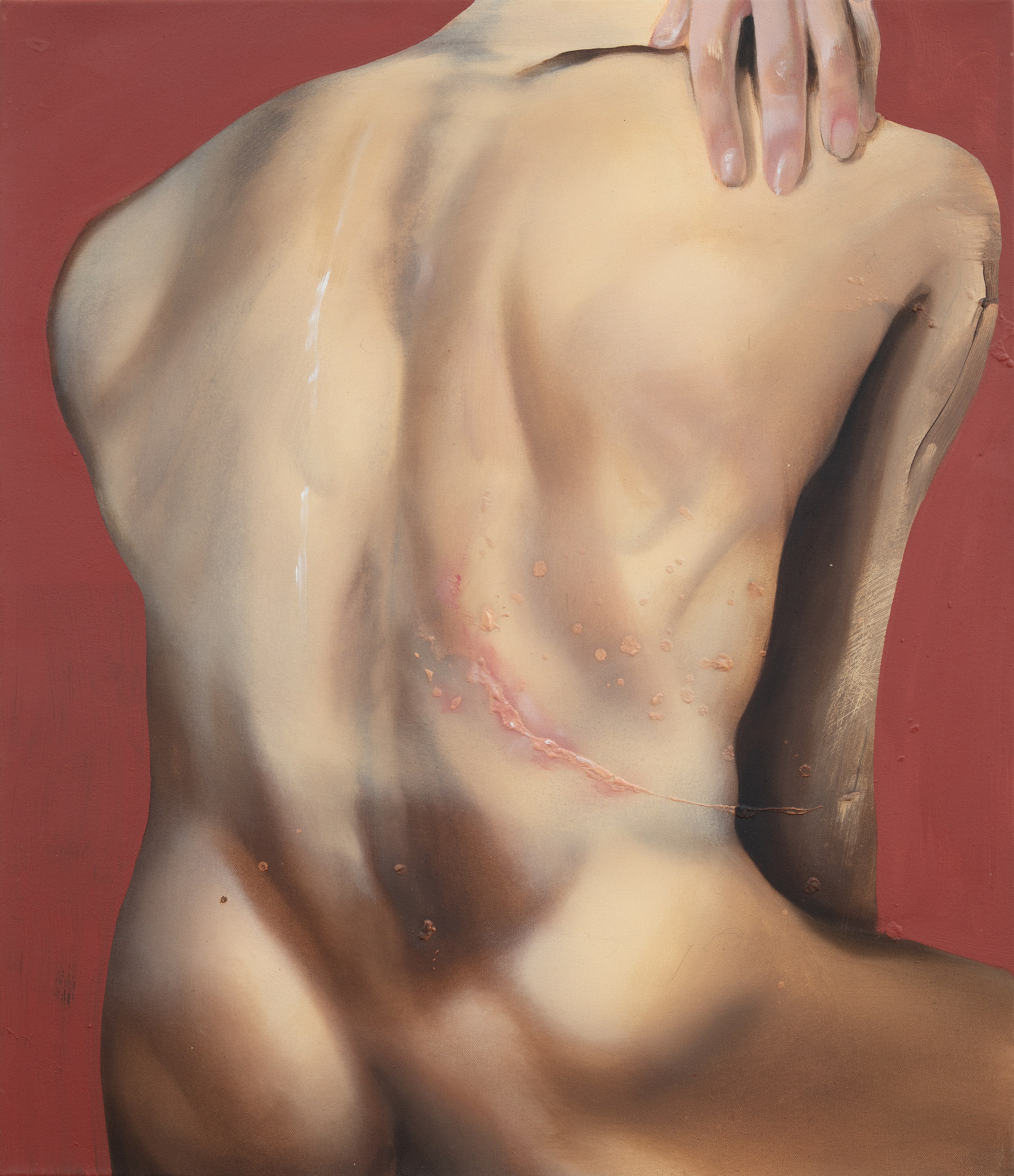 Elsa Rouy, I Pictured Skin at Gnyp Gallery, photo 9