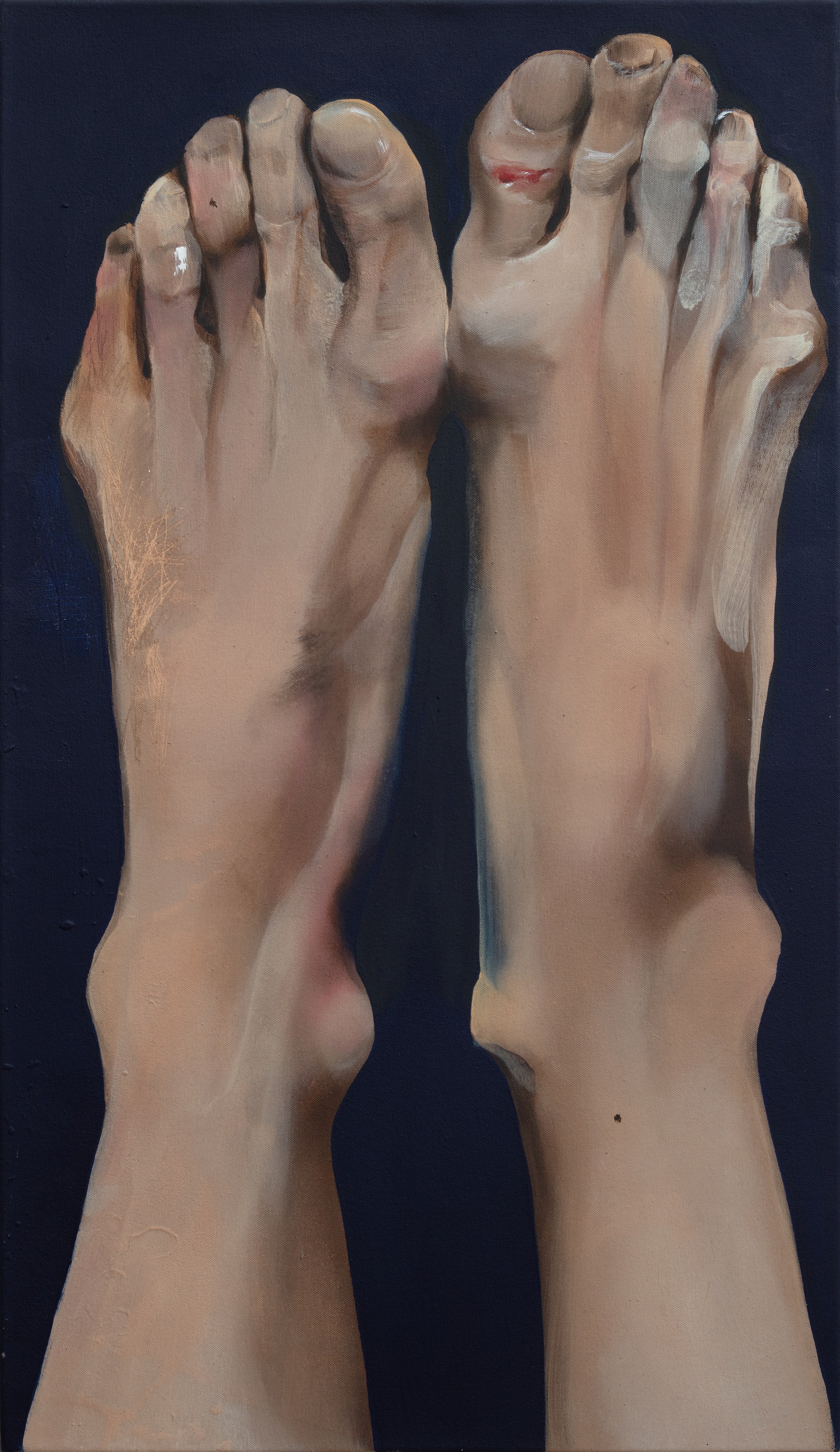 Elsa Rouy, I Pictured Skin at Gnyp Gallery, photo 15