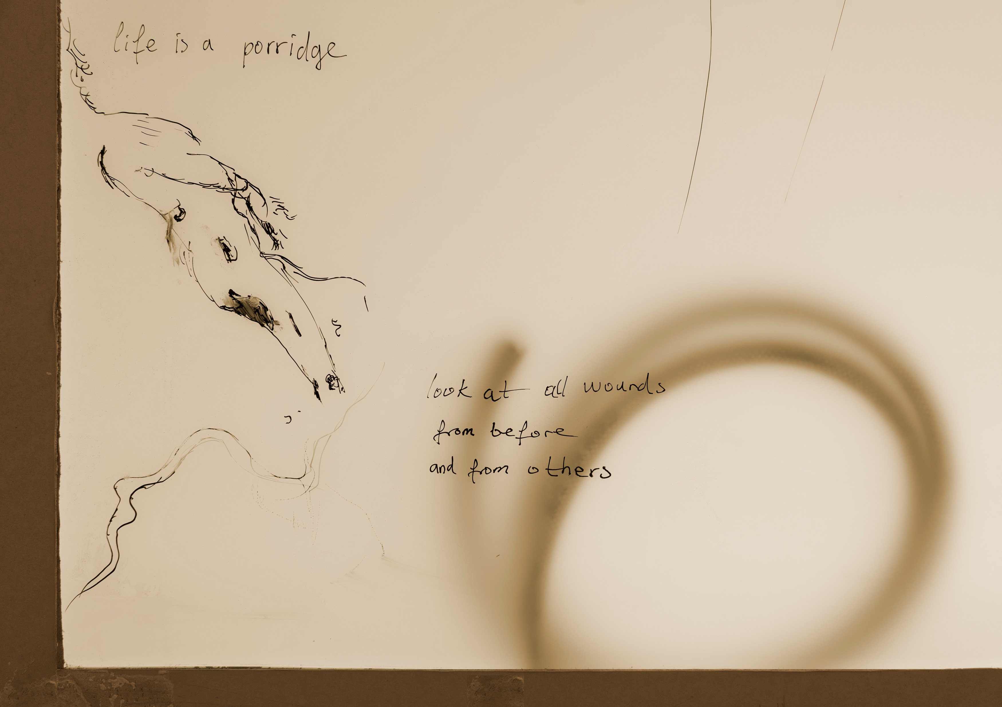 Tolia Astakhishvili, a wound on my plate at Emalin, photo 21