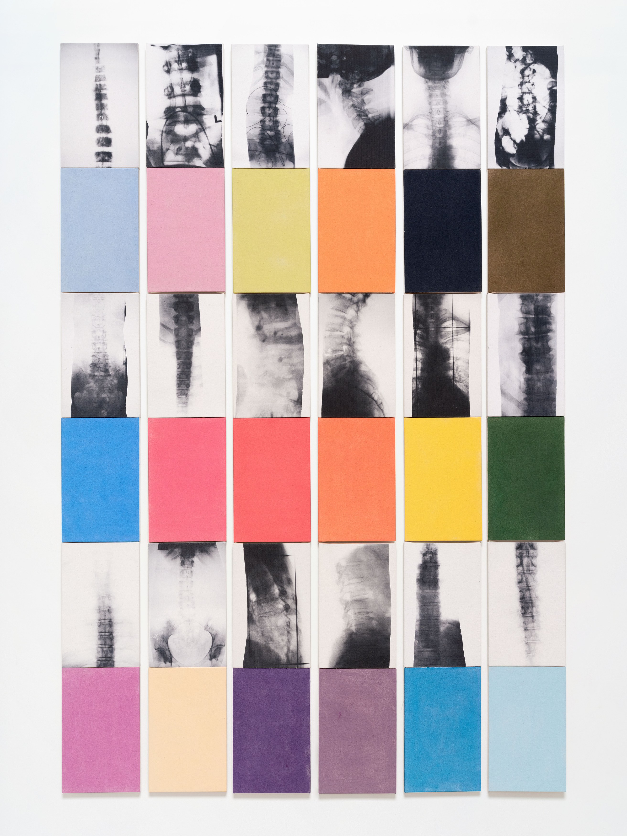 Kunié Sugiura, X-ray Island at Moskowitz Bayse, photo 24